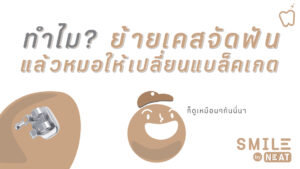 ย้ายเคสจัดฟัน